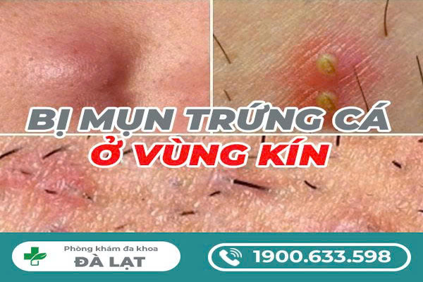 Hình ảnh minh họa